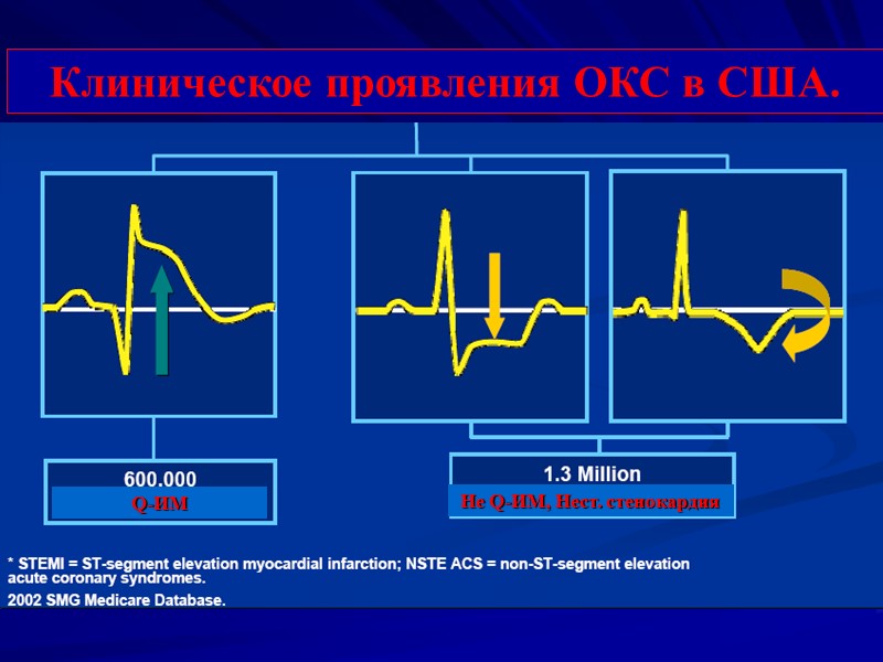 Клиническое проявления ОКС в США. Q-ИМ Не Q-ИМ, Нест. стенокардия